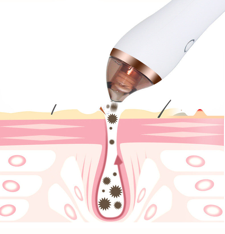 4 in 1 Body Guasha Cupping Blackhead Remover Machine