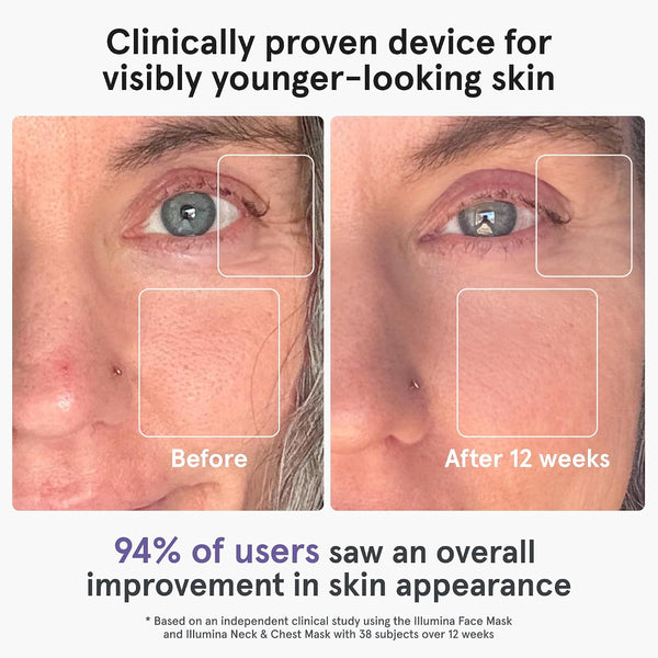 Youthful Glow LED Face Mask