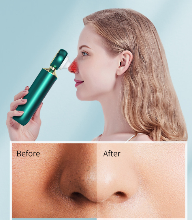 Portable Visual Blackhead Remover Household USB Electric